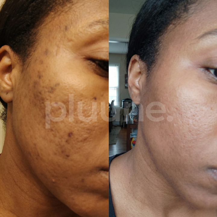 Antes e depois — Nina R.