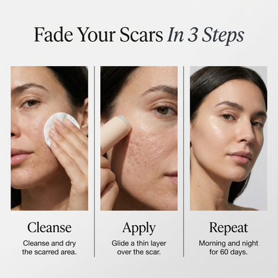 Clinical Acne Scar Repair Stick™.