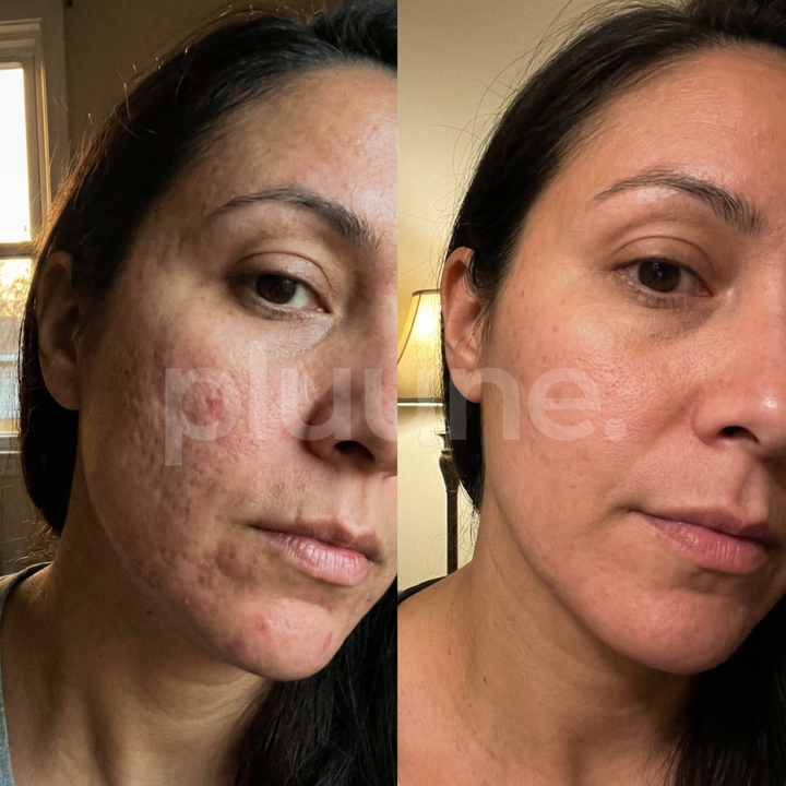 Antes e depois — Sophie L.