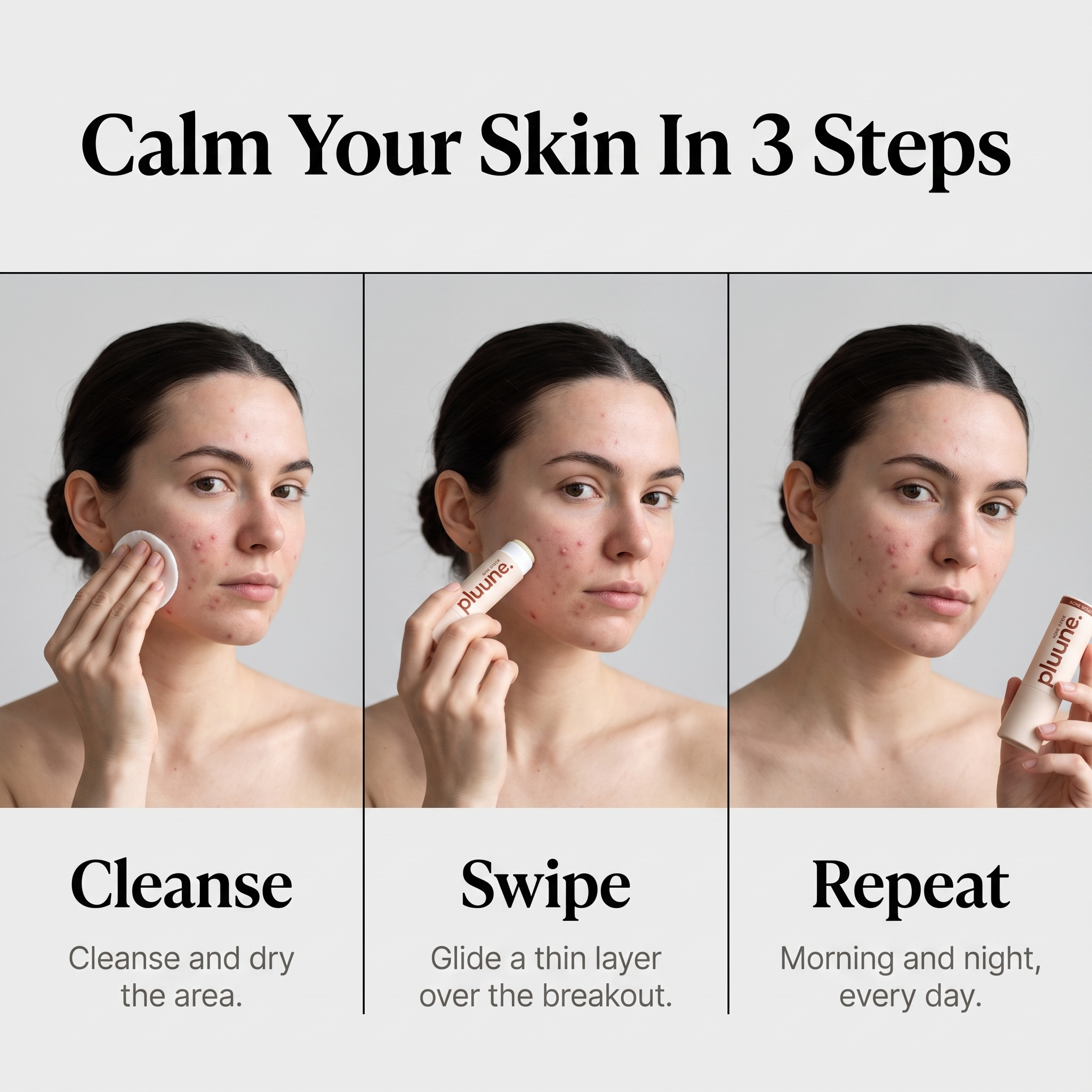 Kill Acne & Redness Stick™