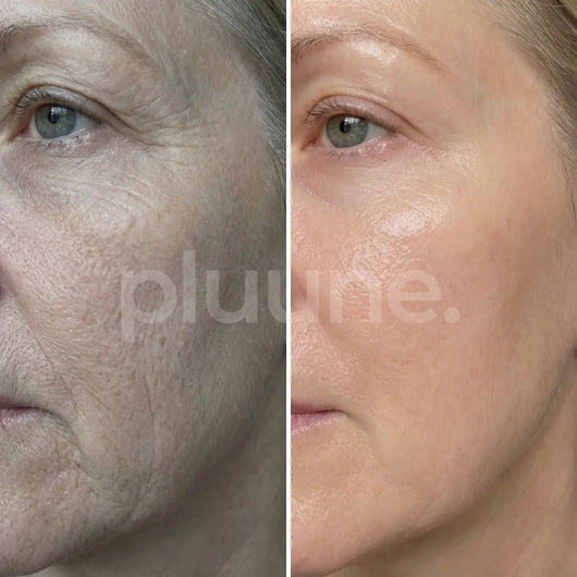 Mature Women’s Skin Recovery Stick™ - Pluune